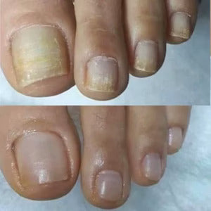 SwissHeal™ - Your Path to Healthier-Looking Nails