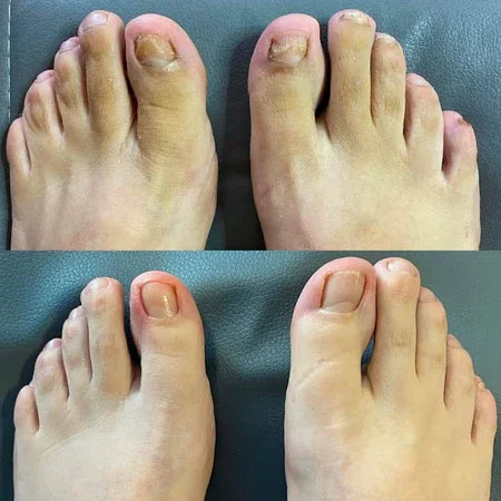 SwissHeal™ - Your Path to Healthier-Looking Nails